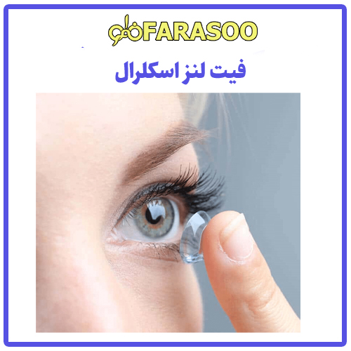 فیت لنز اسکلرال تهران