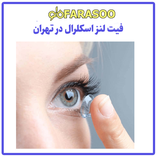 فیت لنز اسکلرال تهران